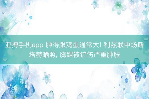 亚搏手机app 肿得跟鸡蛋通常大! 利兹联中场斯塔赫晒照， 脚踝被铲伤严重肿胀