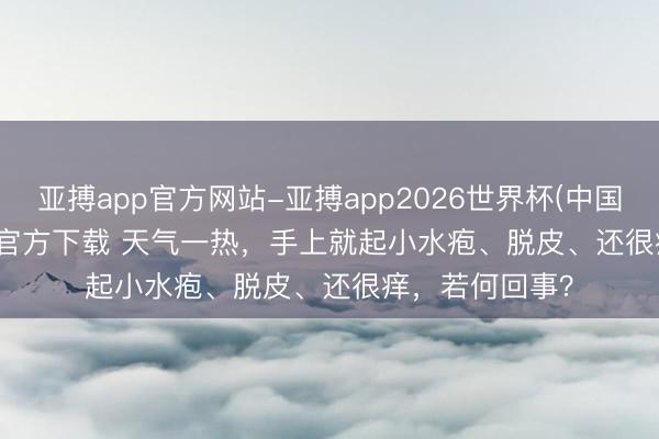 亚搏app官方网站-亚搏app2026世界杯(中国)IOS/Android官方下载 天气一热，手上就起小水疱、脱皮、还很痒，若何回事？
