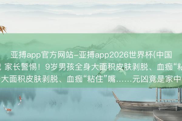 亚搏app官方网站-亚搏app2026世界杯(中国)IOS/Android官方下载 家长警惕！9岁男孩全身大面积皮肤剥脱、血痂“粘住”嘴……元凶竟是家中常用药